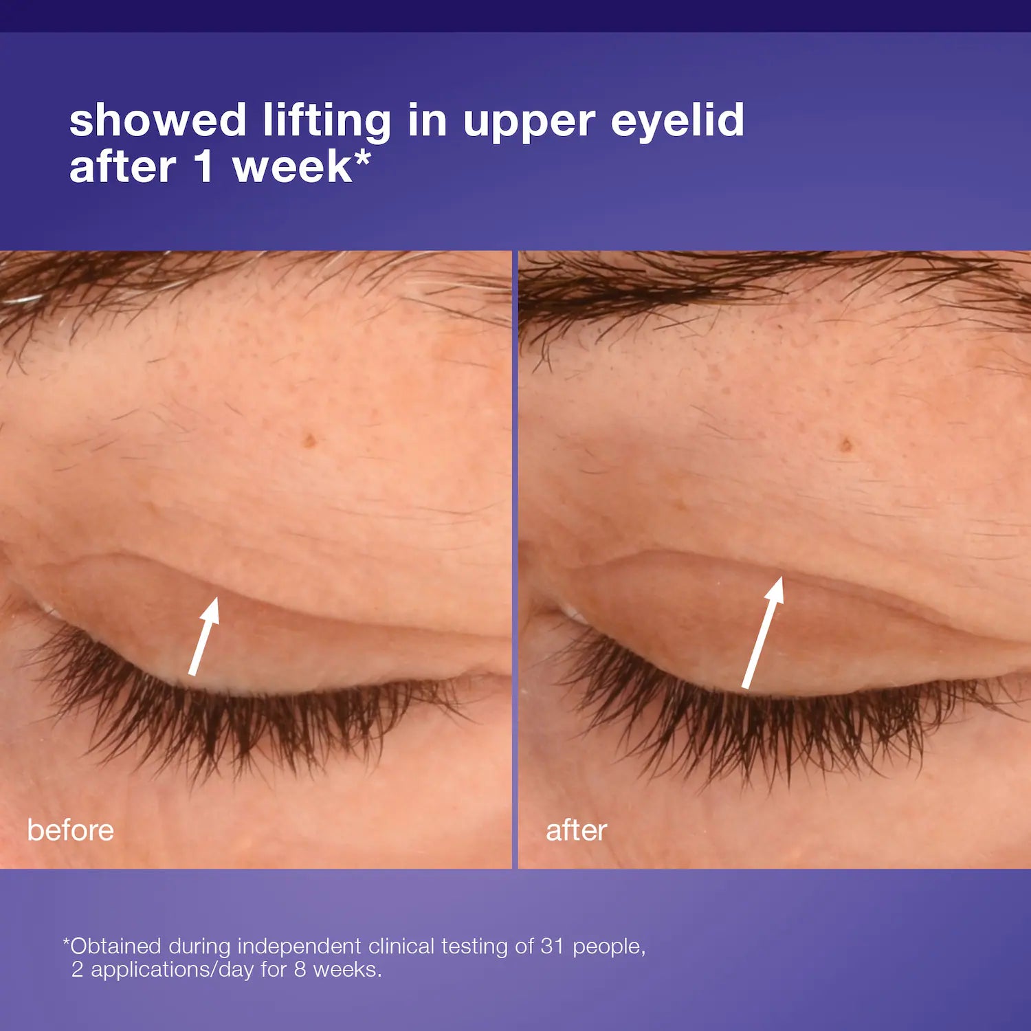 Phyto Nature Lifting Eye Cream